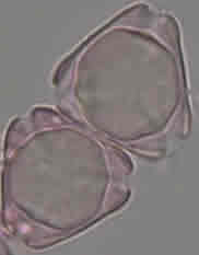 microscopia1